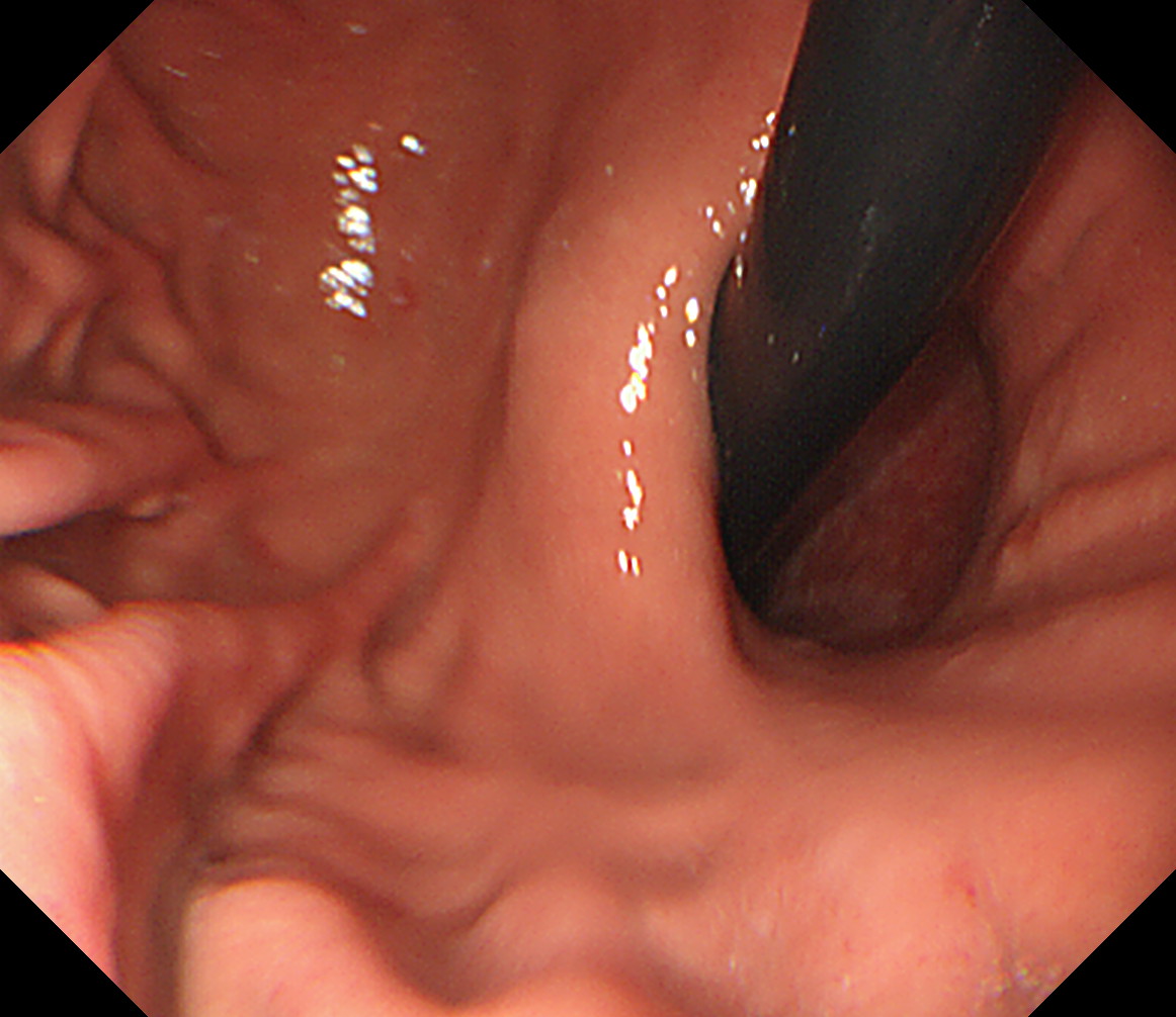 �u⃕��O��